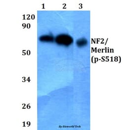 Anti-NF2/Merlin (phospho-S518) Antibody from Bioworld Technology (BS4800) - Antibodies.com