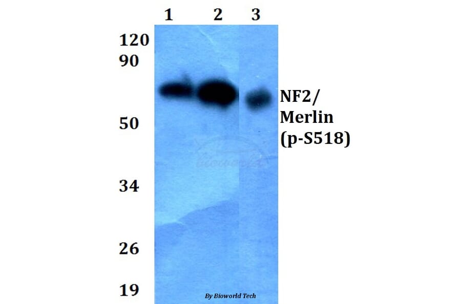 Anti-NF2/Merlin (phospho-S518) Antibody from Bioworld Technology (BS4800) - Antibodies.com