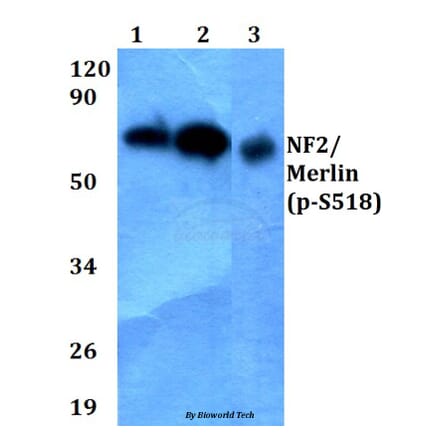 Anti-NF2/Merlin (phospho-S518) Antibody from Bioworld Technology (BS4800) - Antibodies.com