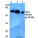 Anti-NF2/Merlin (phospho-S518) Antibody from Bioworld Technology (BS4800) - Antibodies.com