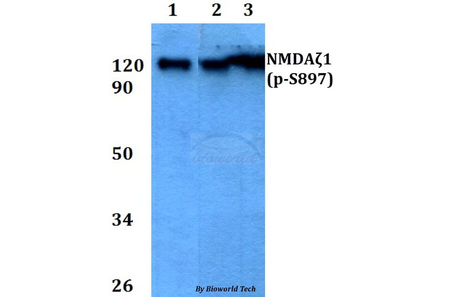 Anti-NMDAζ1 (phospho-S897) Antibody from Bioworld Technology (BS4801) - Antibodies.com