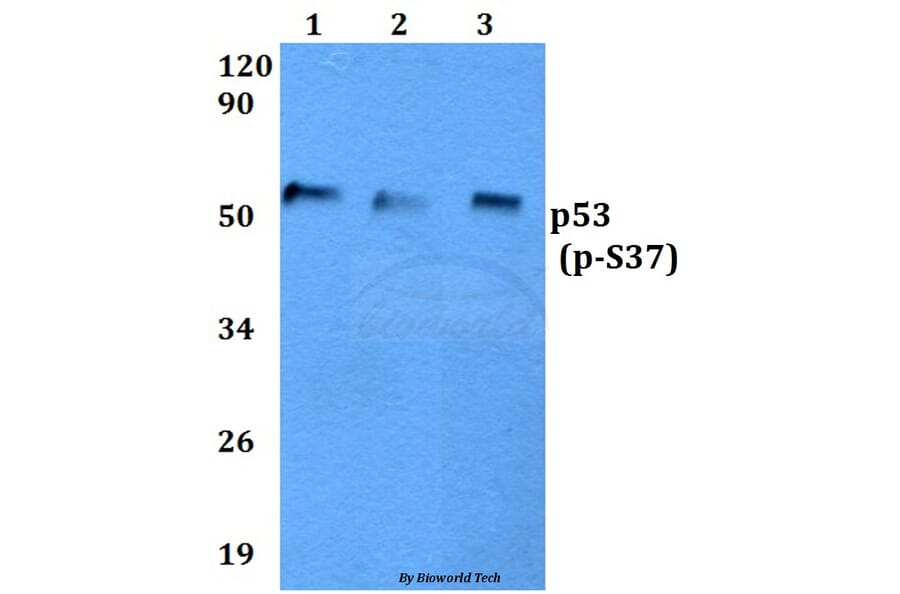 Anti-p53 (phospho-S37) Antibody from Bioworld Technology (BS4836) - Antibodies.com