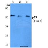 Anti-p53 (phospho-S37) Antibody from Bioworld Technology (BS4836) - Antibodies.com