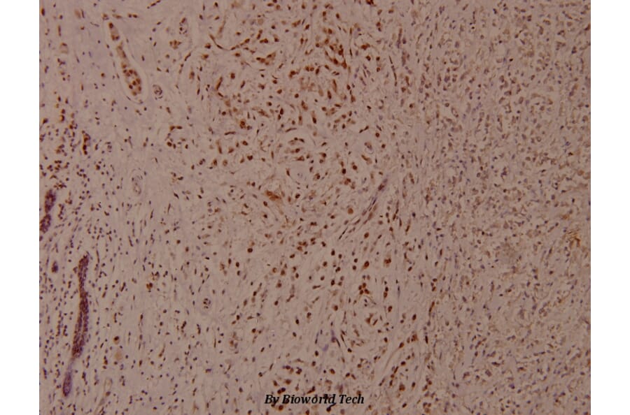 Anti-p53 (phospho-S37) Antibody from Bioworld Technology (BS4836) - Antibodies.com