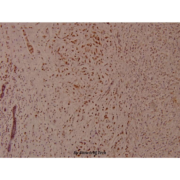 Anti-p53 (phospho-S37) Antibody from Bioworld Technology (BS4836) - Antibodies.com