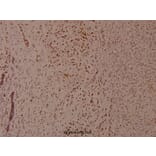 Anti-p53 (phospho-S37) Antibody from Bioworld Technology (BS4836) - Antibodies.com