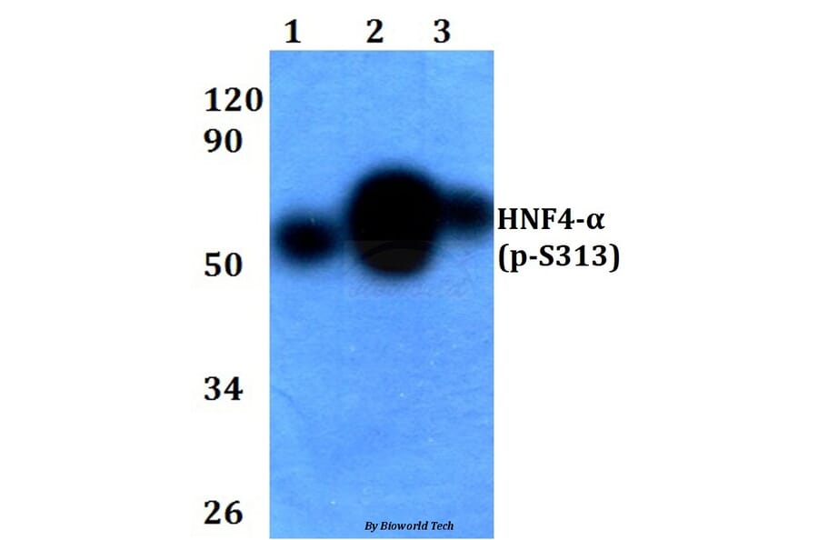 Anti-HNF4α (phospho-S313) Antibody from Bioworld Technology (BS4841) - Antibodies.com