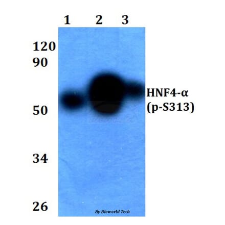 Anti-HNF4α (phospho-S313) Antibody from Bioworld Technology (BS4841) - Antibodies.com