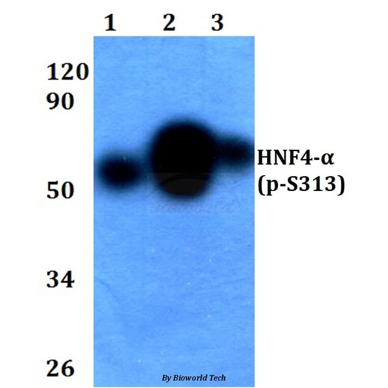 Anti-HNF4α (phospho-S313) Antibody from Bioworld Technology (BS4841) - Antibodies.com
