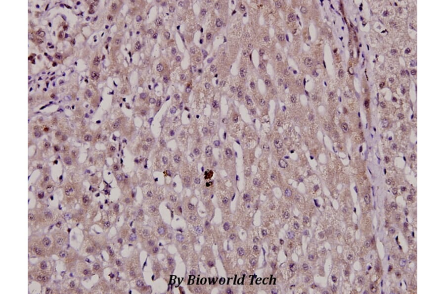 Anti-HNF4α (phospho-S313) Antibody from Bioworld Technology (BS4841) - Antibodies.com