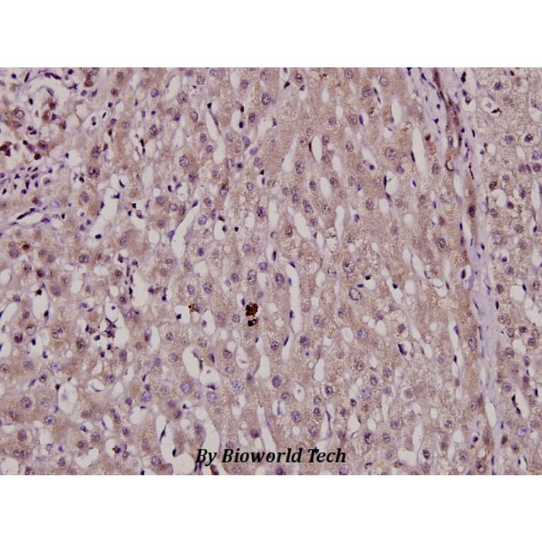 Anti-HNF4α (phospho-S313) Antibody from Bioworld Technology (BS4841) - Antibodies.com