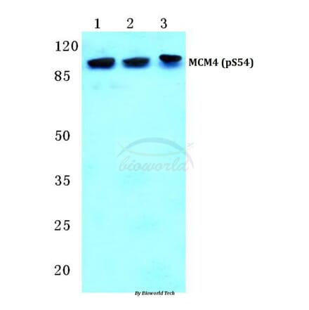 Anti-MCM4 (phospho-S54) Antibody from Bioworld Technology (BS4843) - Antibodies.com