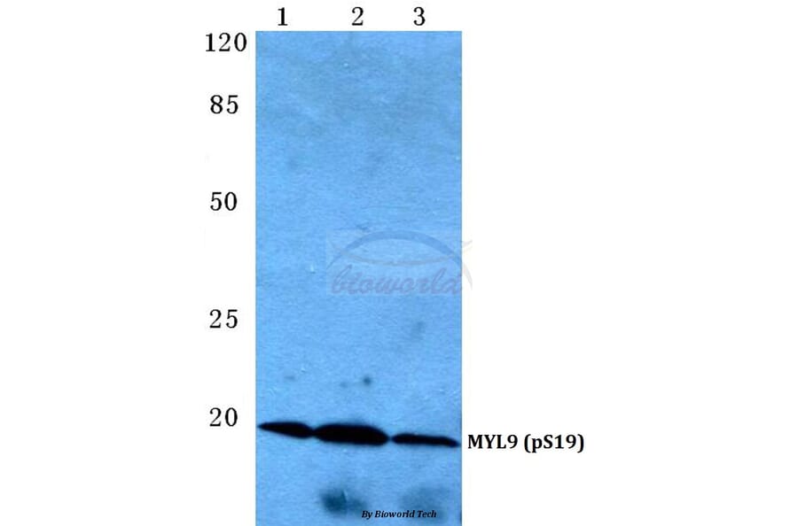Anti-MYL9 (phospho-S19) Antibody from Bioworld Technology (BS4845) - Antibodies.com