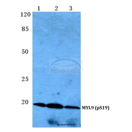 Anti-MYL9 (phospho-S19) Antibody from Bioworld Technology (BS4845) - Antibodies.com