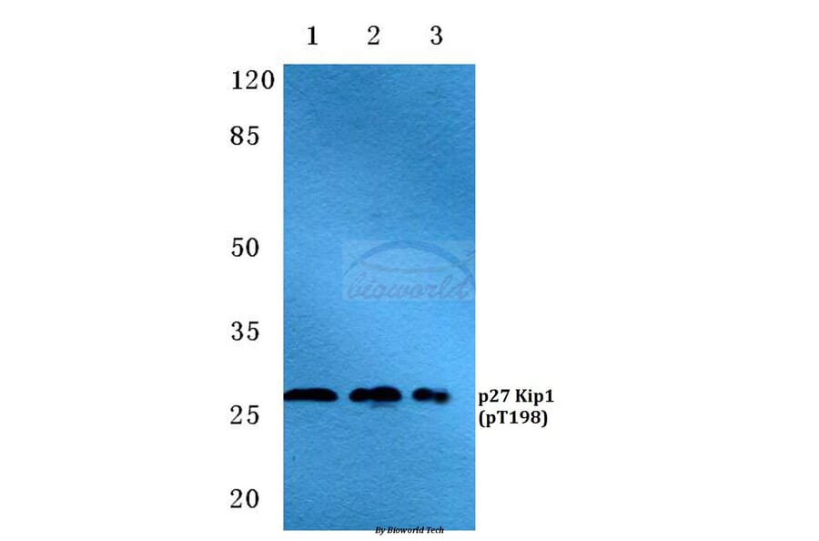 Anti-p27 Kip1 (phospho-T198) Antibody from Bioworld Technology (BS4851) - Antibodies.com