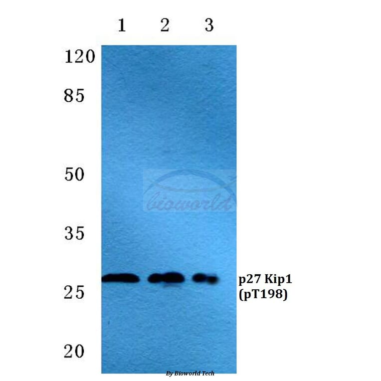 Anti-p27 Kip1 (phospho-T198) Antibody from Bioworld Technology (BS4851) - Antibodies.com