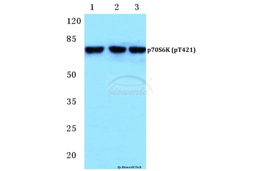 Anti-p70 S6K (phospho-T421) Antibody from Bioworld Technology (BS4853) - Antibodies.com