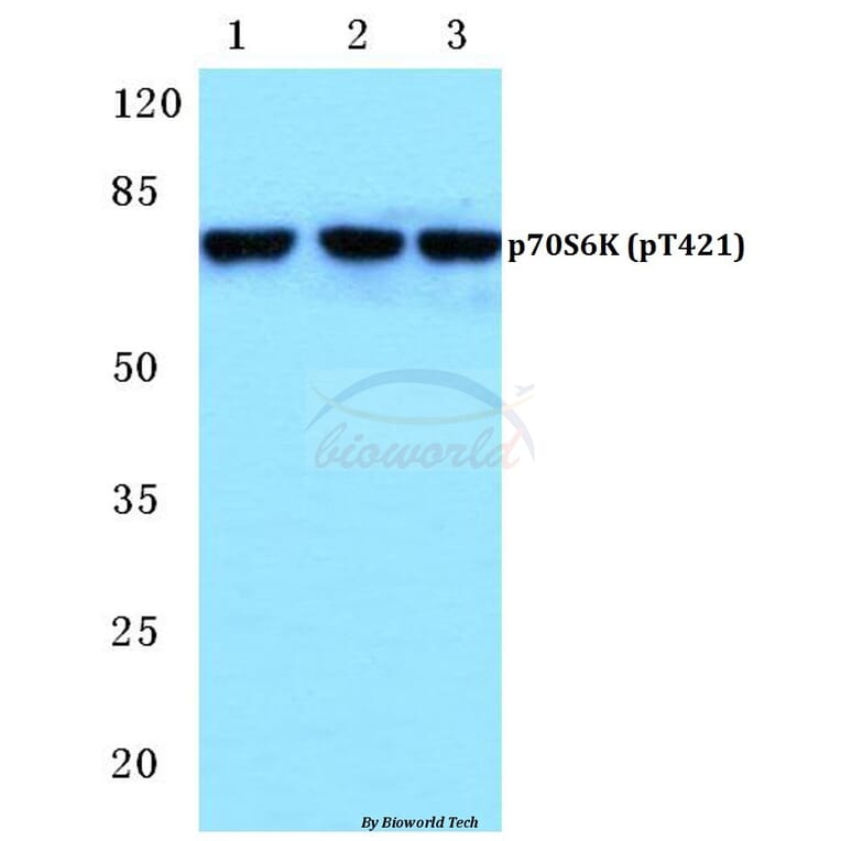 Anti-p70 S6K (phospho-T421) Antibody from Bioworld Technology (BS4853) - Antibodies.com