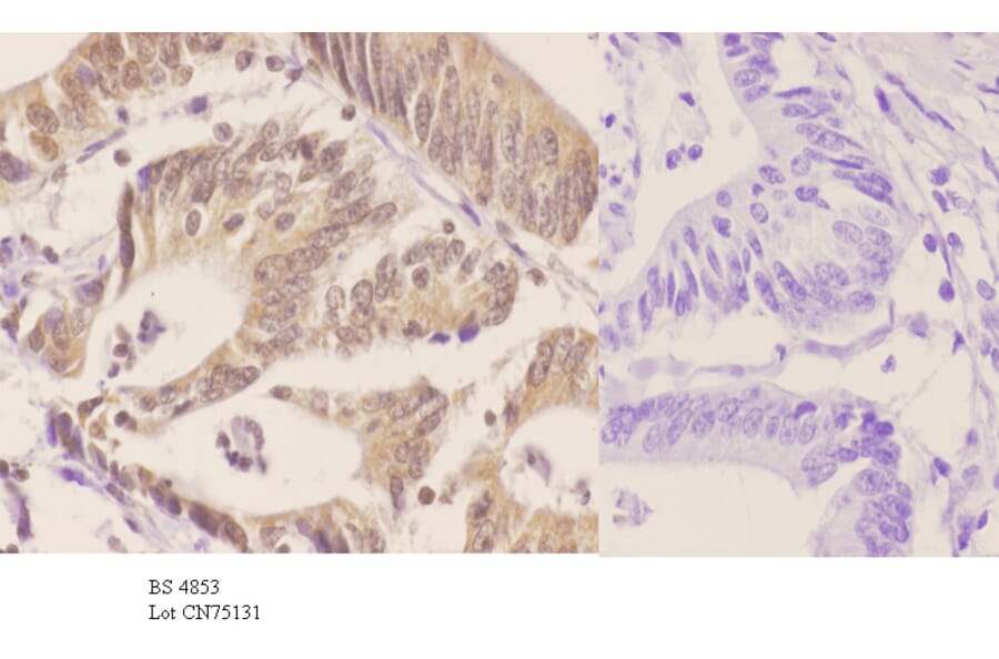 Anti-p70 S6K (phospho-T421) Antibody from Bioworld Technology (BS4853) - Antibodies.com