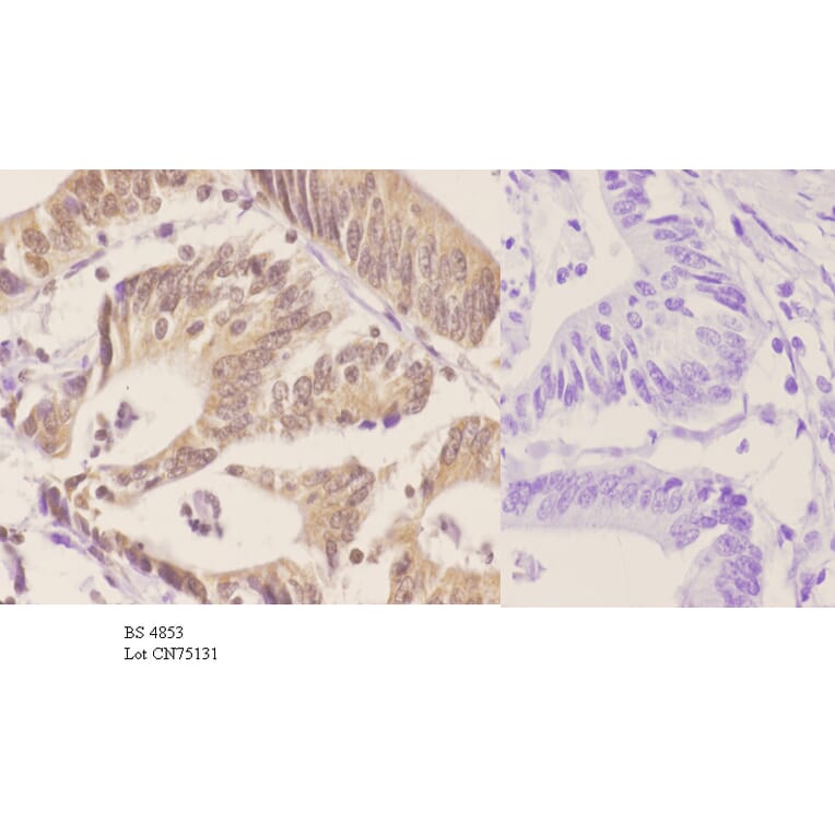 Anti-p70 S6K (phospho-T421) Antibody from Bioworld Technology (BS4853) - Antibodies.com