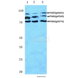 Anti-PAK4/5/6 (phospho-S474) Antibody from Bioworld Technology (BS4854) - Antibodies.com