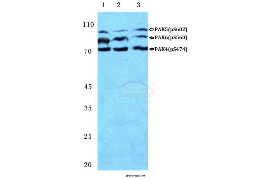 Anti-PAK4/5/6 (phospho-S474) Antibody from Bioworld Technology (BS4854) - Antibodies.com