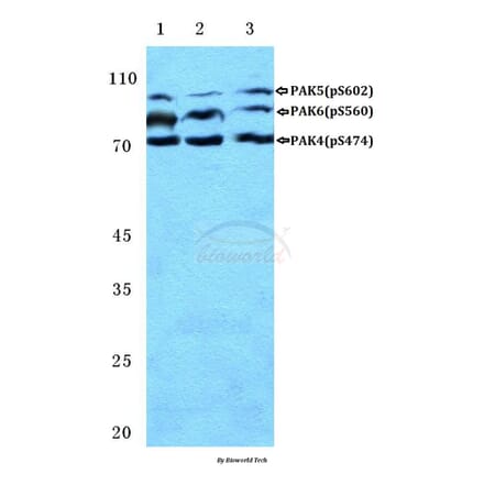 Anti-PAK4/5/6 (phospho-S474) Antibody from Bioworld Technology (BS4854) - Antibodies.com