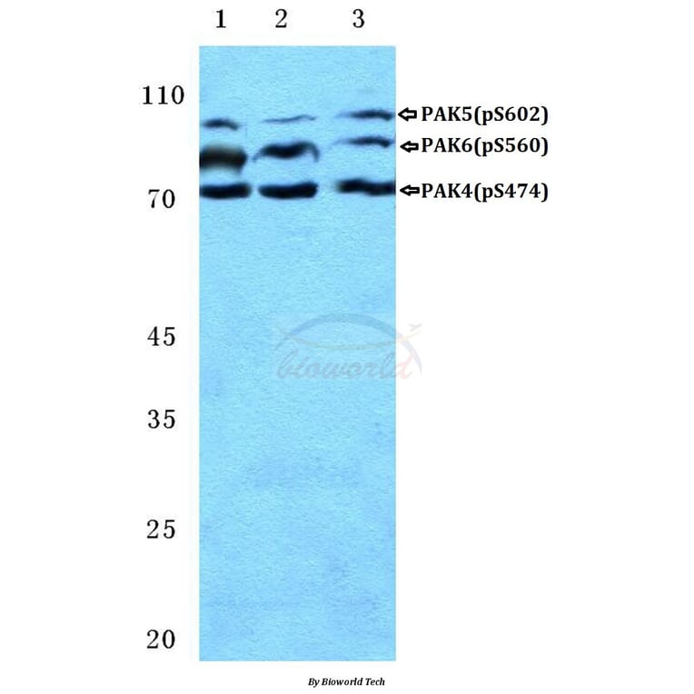 Anti-PAK4/5/6 (phospho-S474) Antibody from Bioworld Technology (BS4854) - Antibodies.com