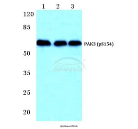 Anti-PAK3 (phospho-S154) Antibody from Bioworld Technology (BS4856) - Antibodies.com