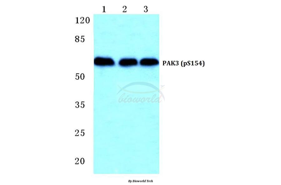 Anti-PAK3 (phospho-S154) Antibody from Bioworld Technology (BS4856) - Antibodies.com