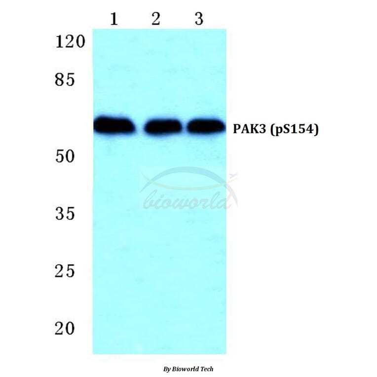 Anti-PAK3 (phospho-S154) Antibody from Bioworld Technology (BS4856) - Antibodies.com