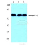 Anti-PAK3 (phospho-S154) Antibody from Bioworld Technology (BS4856) - Antibodies.com