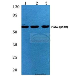 Anti-PAK2 (phospho-S20) Antibody from Bioworld Technology (BS4857) - Antibodies.com