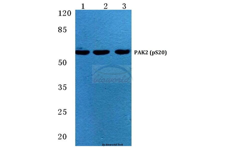 Anti-PAK2 (phospho-S20) Antibody from Bioworld Technology (BS4857) - Antibodies.com