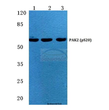 Anti-PAK2 (phospho-S20) Antibody from Bioworld Technology (BS4857) - Antibodies.com
