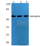 Anti-PAK2 (phospho-S20) Antibody from Bioworld Technology (BS4857) - Antibodies.com
