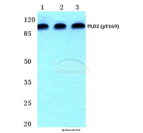Anti-PLD2 (phospho-Y169) Antibody from Bioworld Technology (BS4858) - Antibodies.com