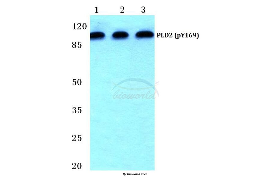 Anti-PLD2 (phospho-Y169) Antibody from Bioworld Technology (BS4858) - Antibodies.com