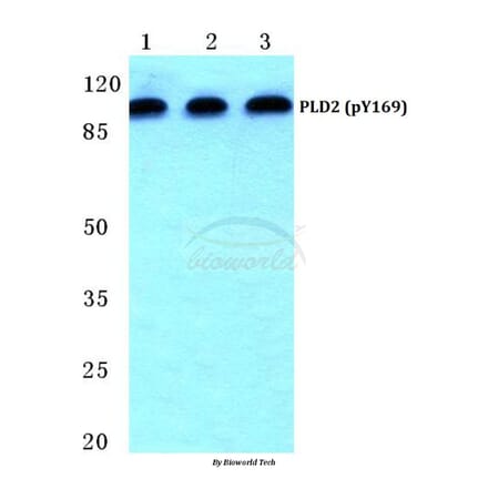 Anti-PLD2 (phospho-Y169) Antibody from Bioworld Technology (BS4858) - Antibodies.com