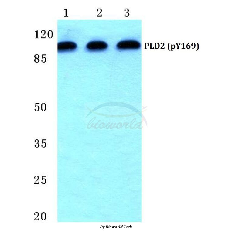 Anti-PLD2 (phospho-Y169) Antibody from Bioworld Technology (BS4858) - Antibodies.com