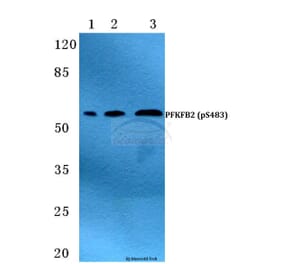 Anti-PFKFB2 (phospho-S483) Antibody from Bioworld Technology (BS4859) - Antibodies.com