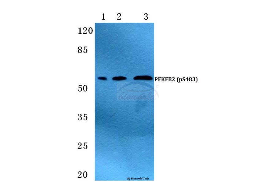 Anti-PFKFB2 (phospho-S483) Antibody from Bioworld Technology (BS4859) - Antibodies.com