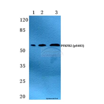 Anti-PFKFB2 (phospho-S483) Antibody from Bioworld Technology (BS4859) - Antibodies.com