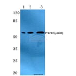 Anti-PFKFB2 (phospho-S483) Antibody from Bioworld Technology (BS4859) - Antibodies.com