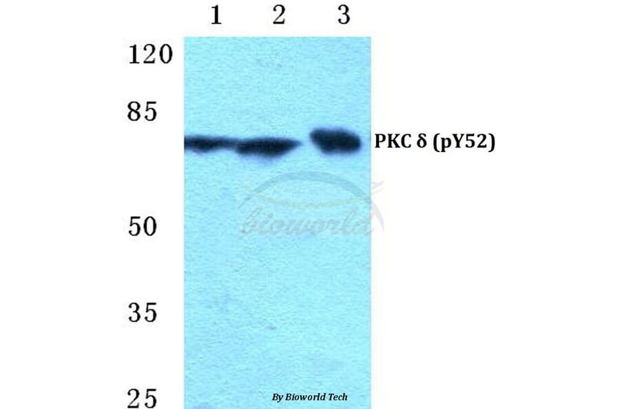 Anti-PKC δ (phospho-Y52) Antibody from Bioworld Technology (BS4861) - Antibodies.com