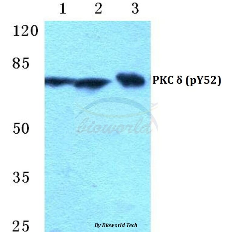 Anti-PKC δ (phospho-Y52) Antibody from Bioworld Technology (BS4861) - Antibodies.com