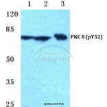 Anti-PKC δ (phospho-Y52) Antibody from Bioworld Technology (BS4861) - Antibodies.com