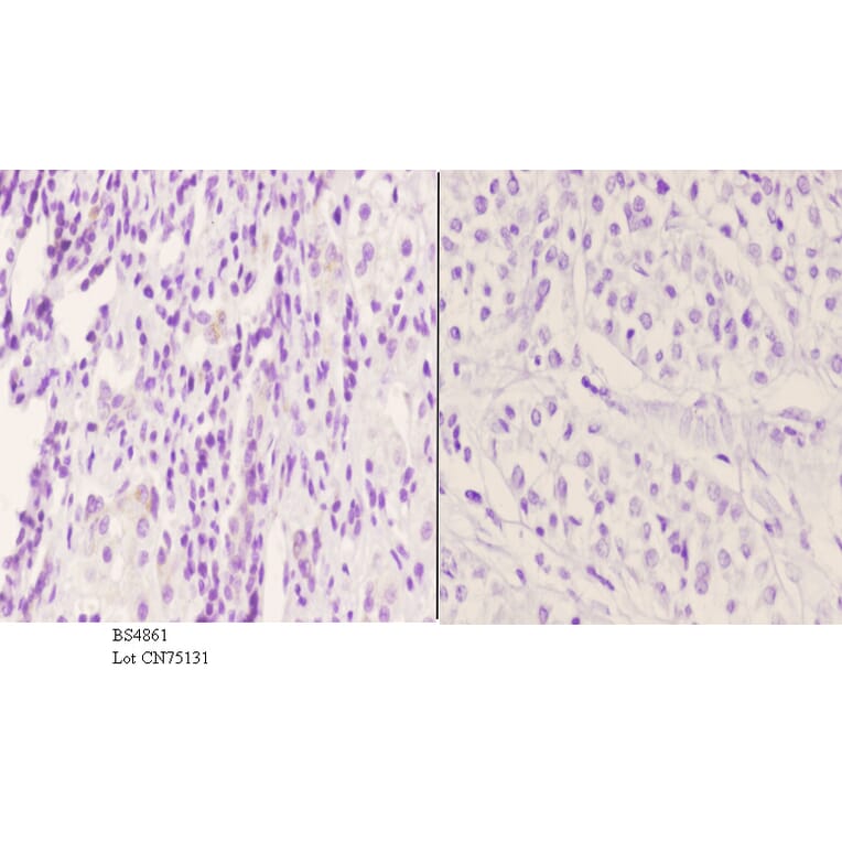 Anti-PKC δ (phospho-Y52) Antibody from Bioworld Technology (BS4861) - Antibodies.com