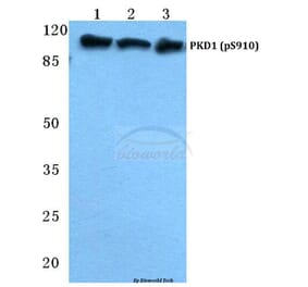 Anti-PKD1 (phospho-S910) Antibody from Bioworld Technology (BS4862) - Antibodies.com
