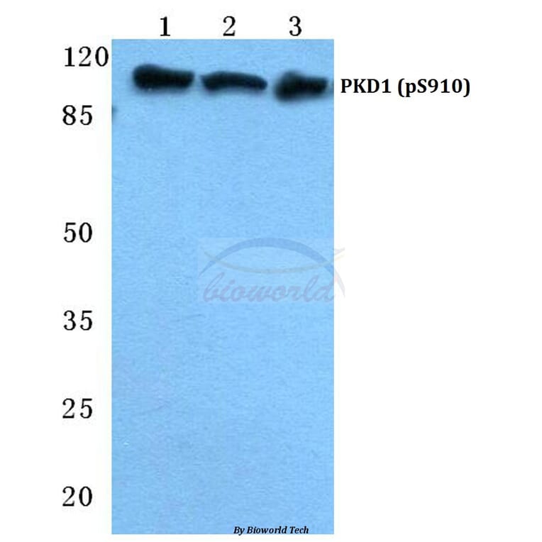 Anti-PKD1 (phospho-S910) Antibody from Bioworld Technology (BS4862) - Antibodies.com
